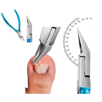 Sarokcsípő ferde fejjel